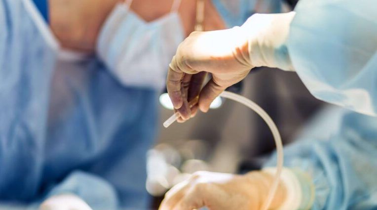 TAD Στοχευμένη Λεμφαδενεκτομή