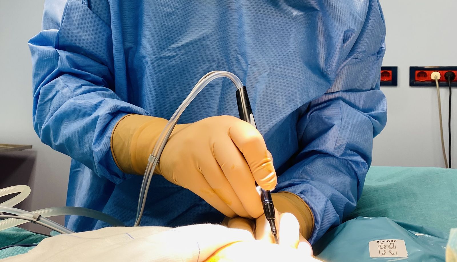 Μαστεκτομή