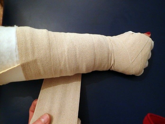 Ο ρόλος της φυσικοθεραπείας στην πρόληψη του λεμφοιδήματος