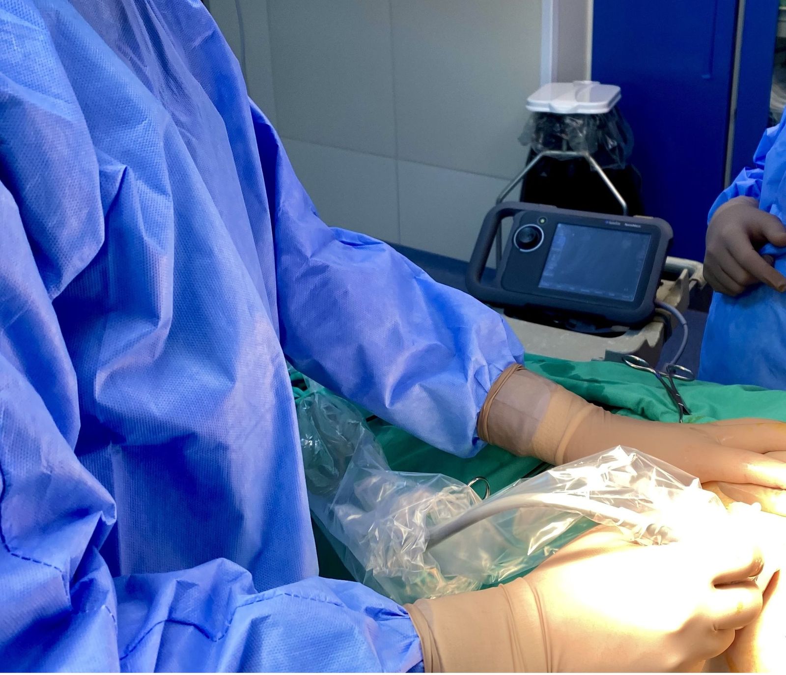 Διεγχειρητικό Υπερηχογράφημα σε Επεμβάσεις Μαστού