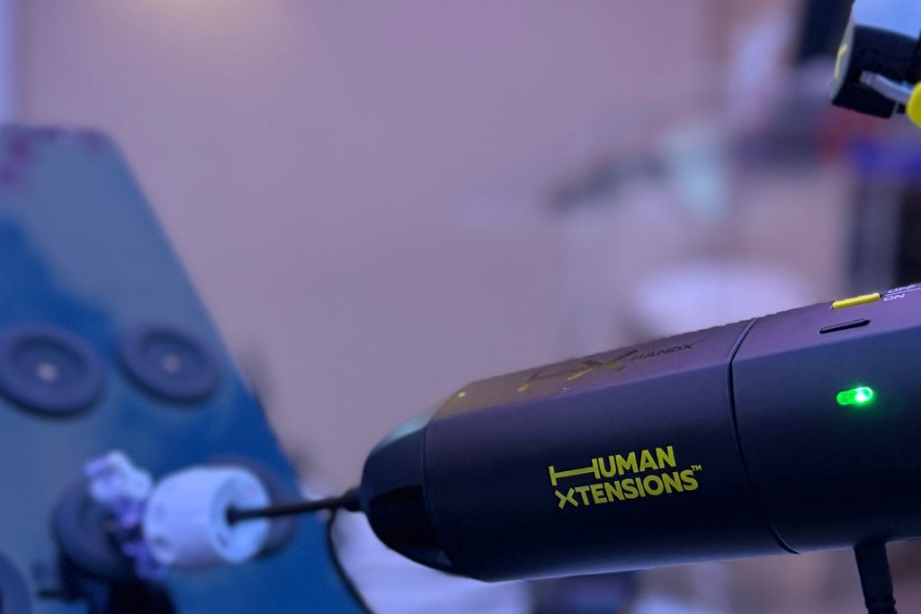 Ενδοσκοπική Μαστεκτομή με το Ρομποτικό Σύστημα HandX®: Μια Επανάσταση στη Χειρουργική του Μαστού